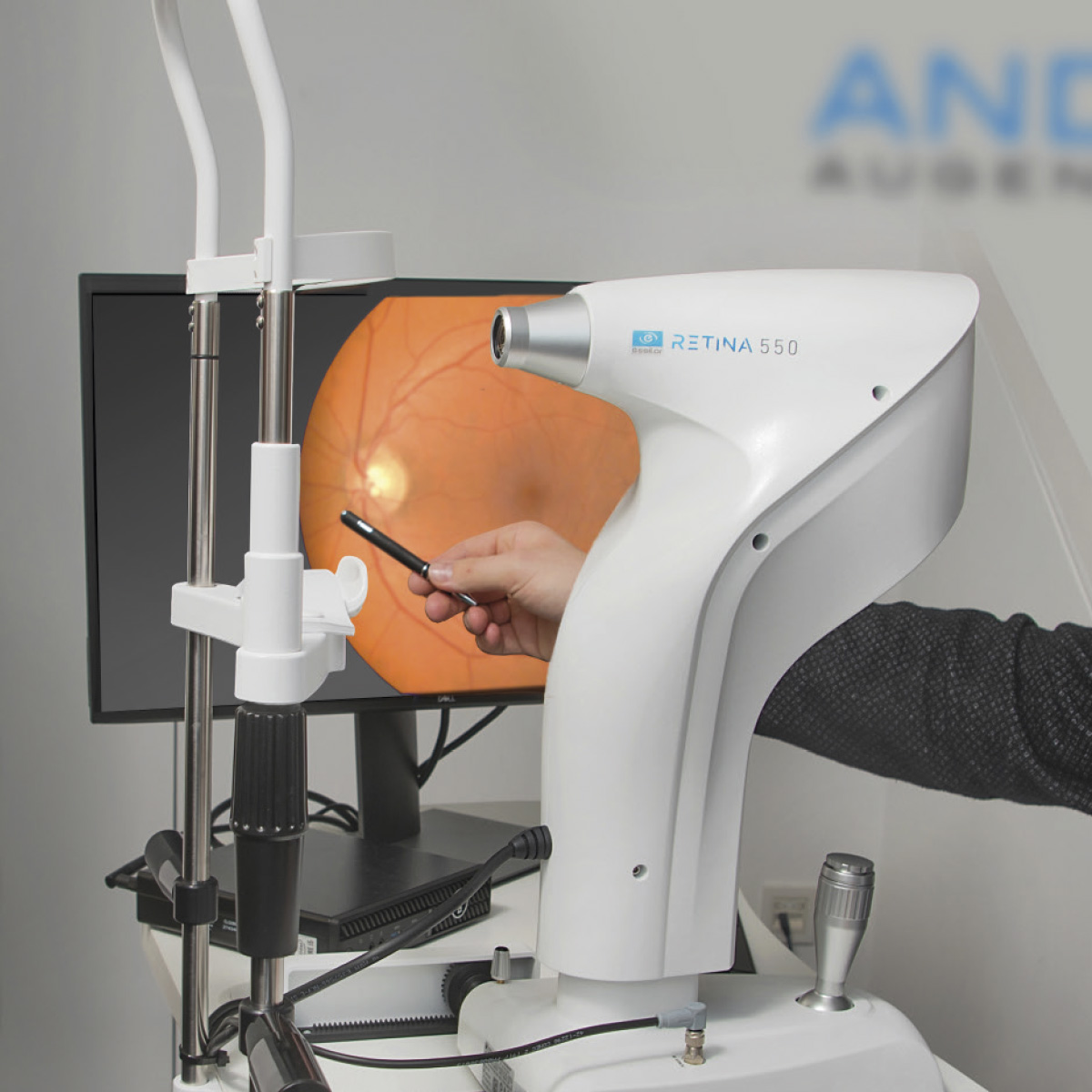 Optometrie_Augenscreening_Netzhaut_Andre-Augenoptik